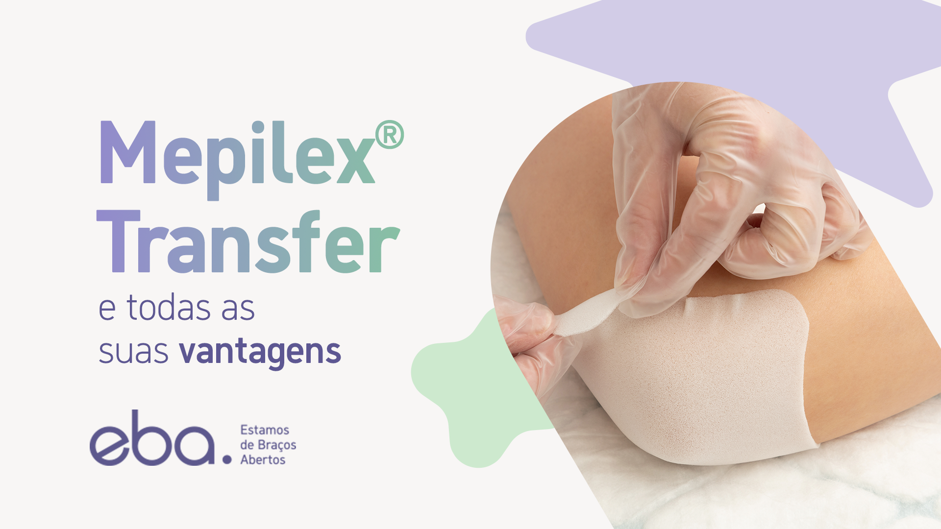 mepilex transfer